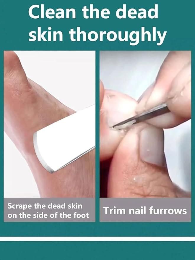 Pedicure Knife Set with Storage Case